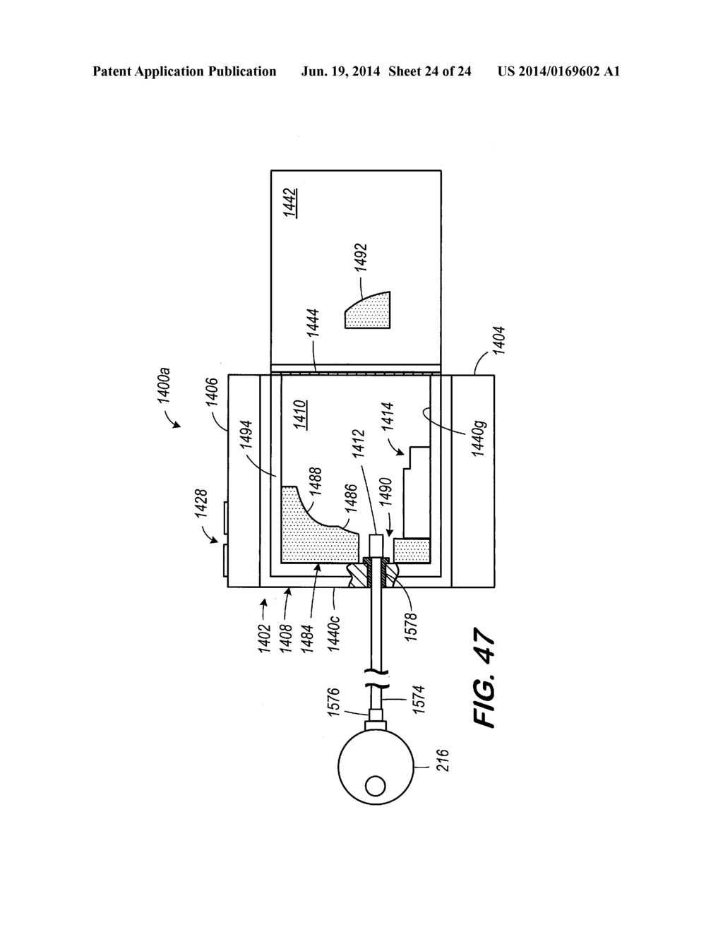 Speech Processor Cases - diagram, schematic, and image 25