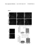 PRESERVATION OF THE NEUROMUSCULAR JUNCTION (NMJ) AFTER TRAUMATIC NERVE     INJURY diagram and image