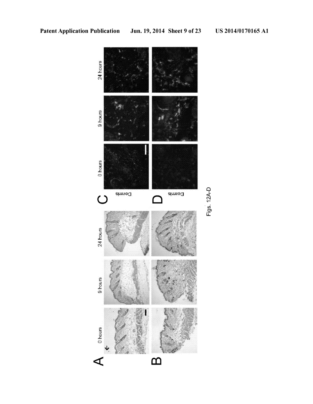 METHODS OF GENERATING HYPER INOS EXPRESSING CELLS AND USES THEREOF - diagram, schematic, and image 10