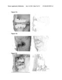 BIOABSORBABLE POLYMERS diagram and image