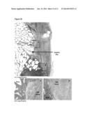 BIOABSORBABLE POLYMERS diagram and image