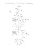 IONIZER FOR A COMBUSTION SYSTEM, INCLUDING FOAM ELECTRODE STRUCTURE diagram and image