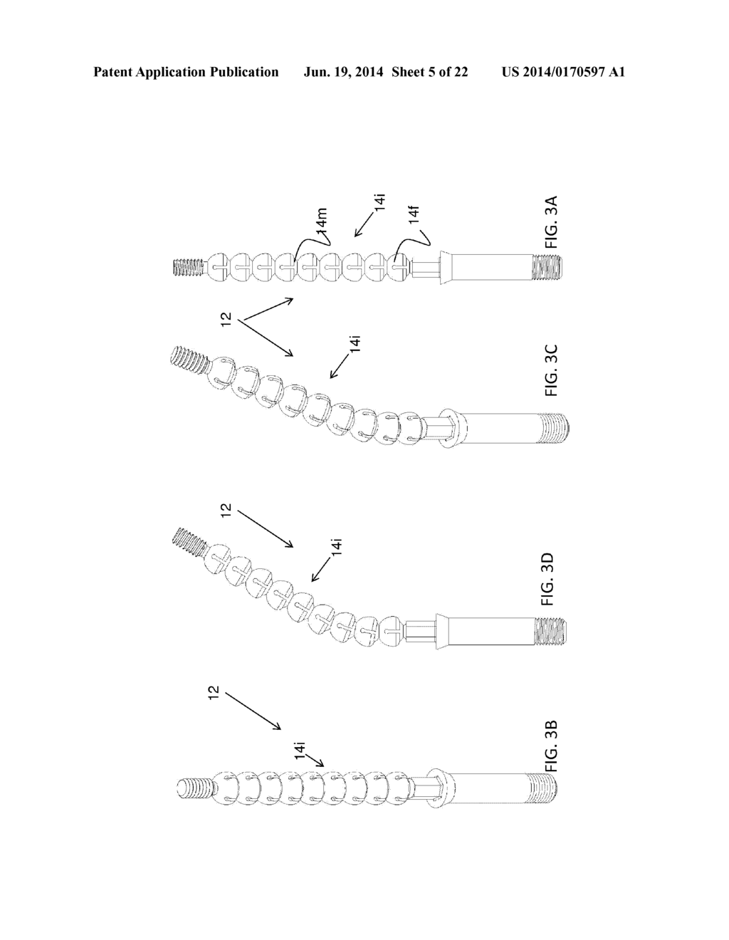 DEVICE, SYSTEM AND METHOD FOR PROSTHODONTIC RESTORATION - diagram, schematic, and image 06