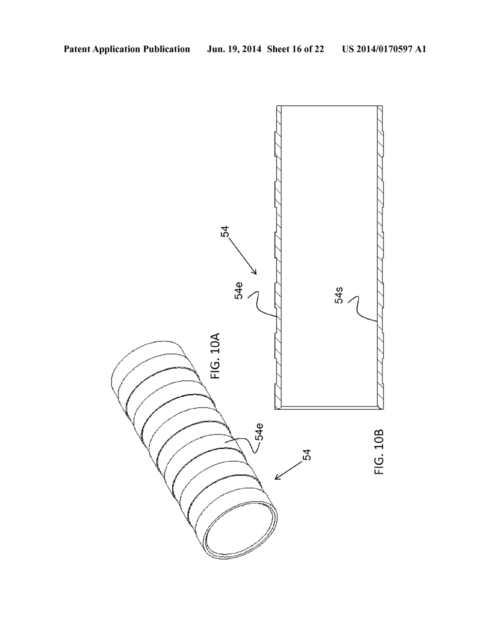 DEVICE, SYSTEM AND METHOD FOR PROSTHODONTIC RESTORATION - diagram, schematic, and image 17