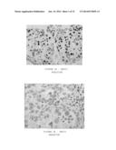 EXPRESSION OF ISOFORM 202 OF ERCC1 FOR PREDICTING RESPONSE TO CANCER     CHEMOTHERAPY diagram and image