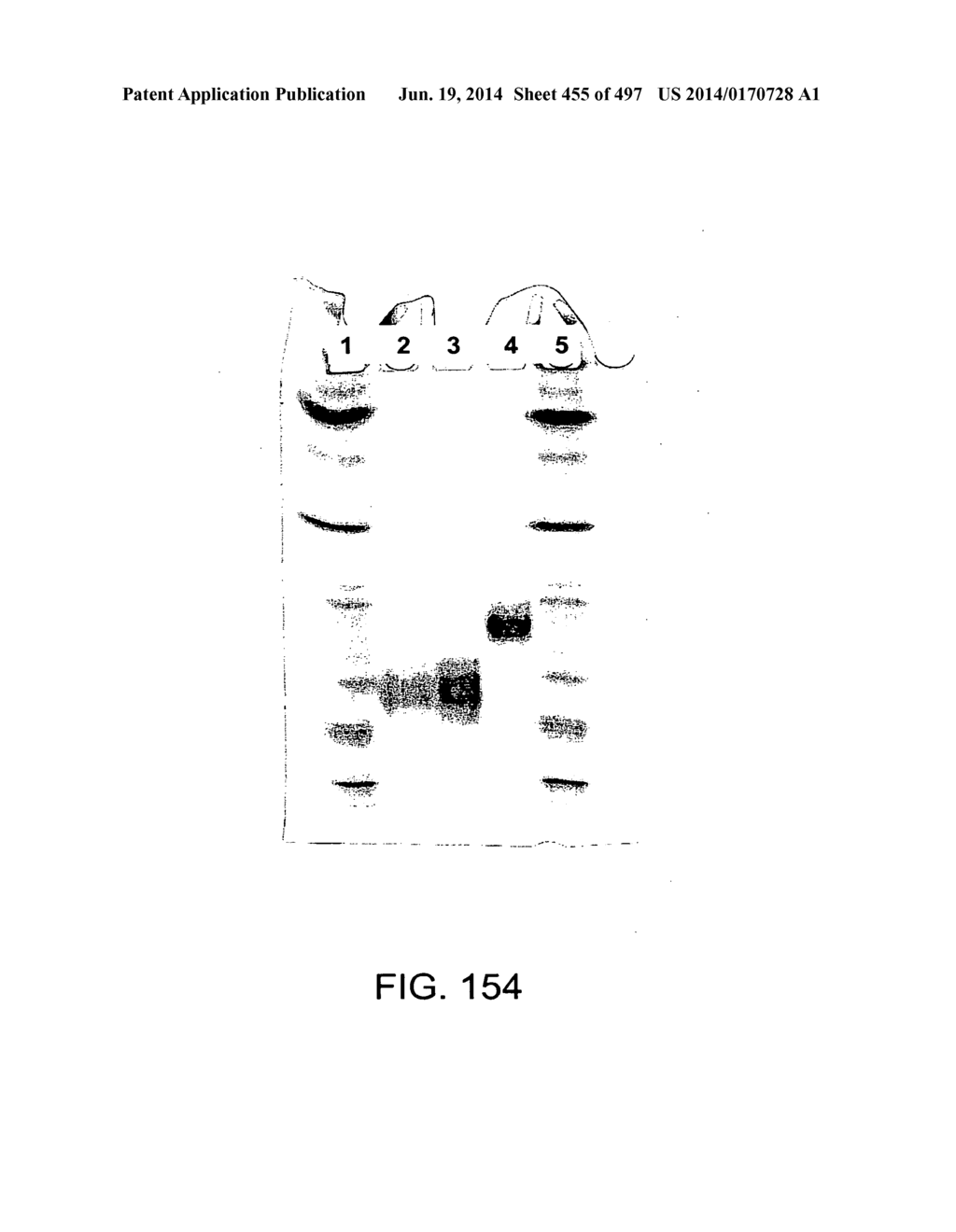 Factor IX:  Remodeling and Glycoconjugation of Factor IX - diagram, schematic, and image 456