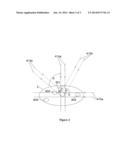 DOSE-OPTIMISED PATIENT POSITIONING FOR RADIOTHERAPY diagram and image