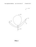 TRANS-VAGINAL SLING DELIVERY DEVICE diagram and image