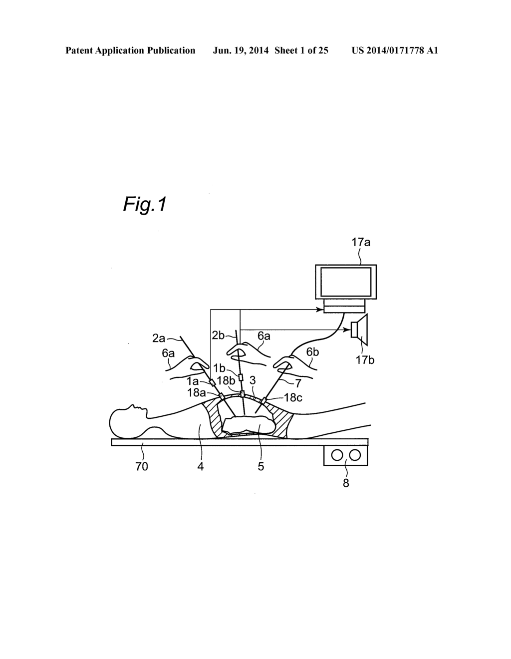 FORCE MEASUREMENT APPARATUS, FORCE MEASUREMENT METHOD, FORCE MEASUREMENT     PROGRAM, FORCE MEASUREMENT INTEGRATED ELECTRONIC CIRCUIT, AND     MASTER-SLAVE DEVICE - diagram, schematic, and image 02