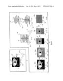 ULTRASOUND DIAGNOSTIC DEVICE AND ULTRASOUND IMAGE DISPLAY METHOD diagram and image