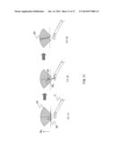 ULTRASOUND DIAGNOSTIC DEVICE AND ULTRASOUND IMAGE DISPLAY METHOD diagram and image