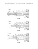 VACUUM ASSISTED LANCING SYSTEM WITH ELECTIVE VACUUM RELEASE AND METHOD FOR     BLOOD EXTRACTION WITH MINIMAL PAIN diagram and image