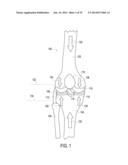 ORTHOTIC BRACE diagram and image