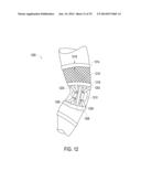 ORTHOTIC BRACE diagram and image