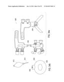 ORTHOTIC BRACE diagram and image