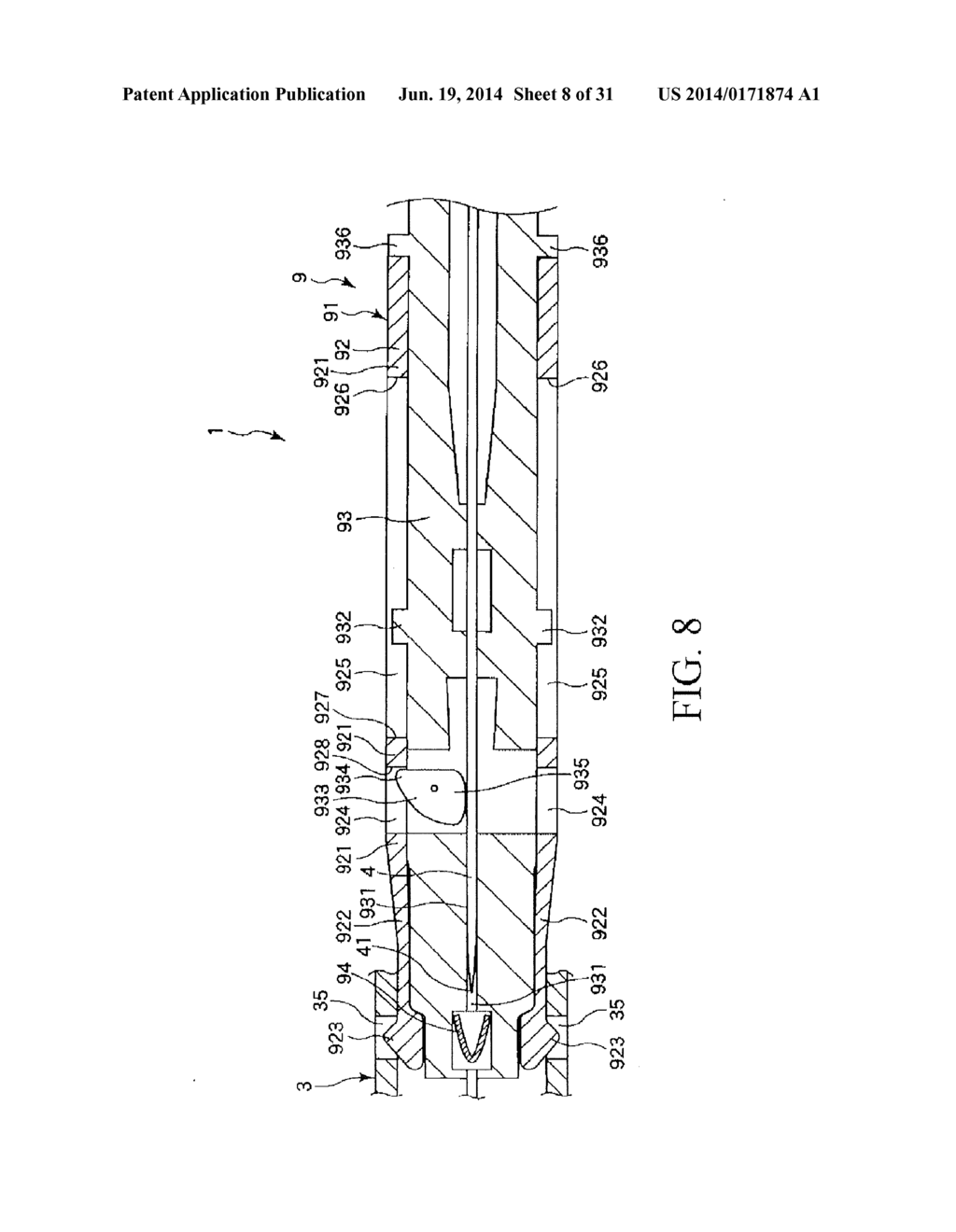 INDWELLING NEEDLE ASSEMBLY - diagram, schematic, and image 09