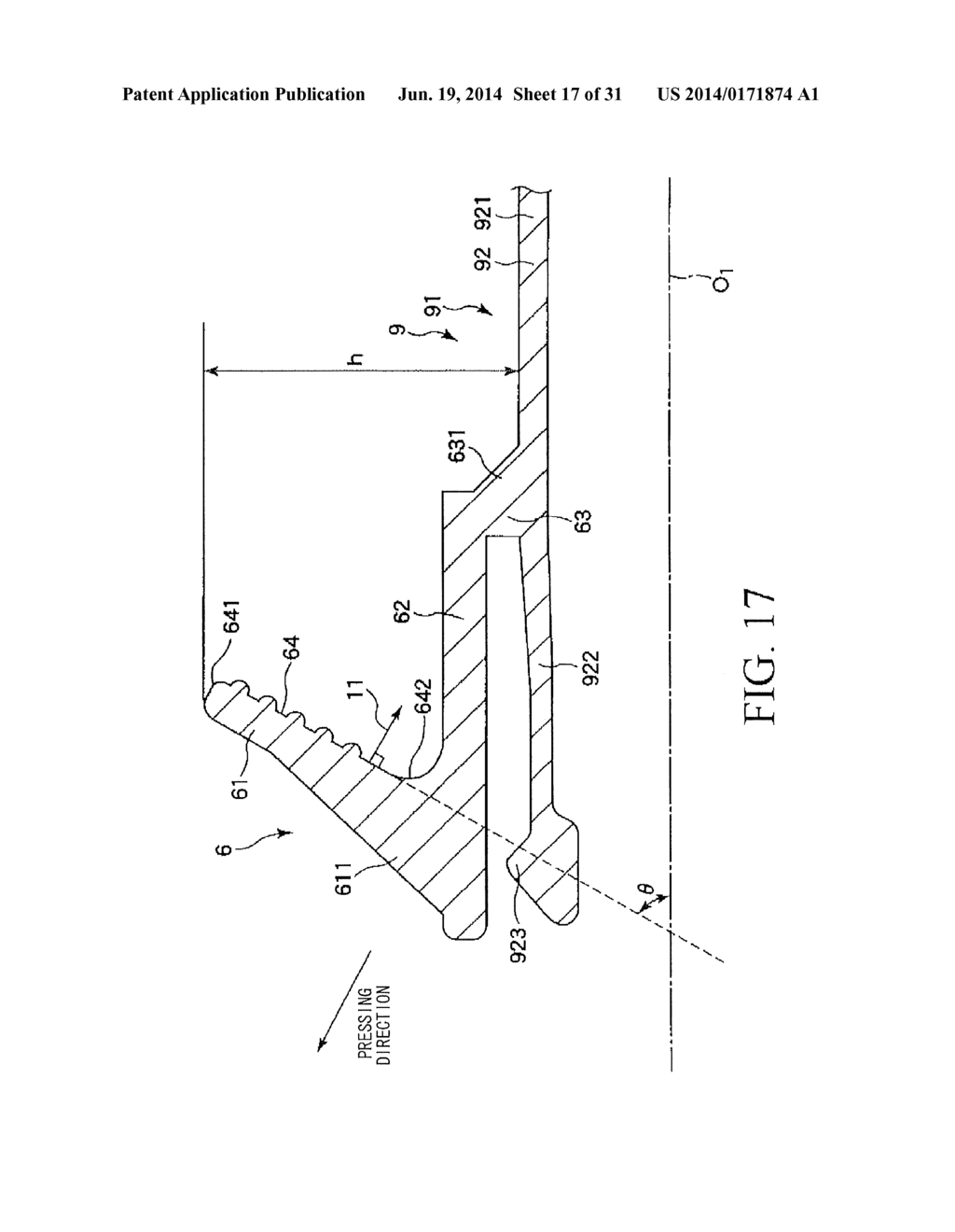 INDWELLING NEEDLE ASSEMBLY - diagram, schematic, and image 18