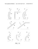 INDWELLING NEEDLE ASSEMBLY diagram and image