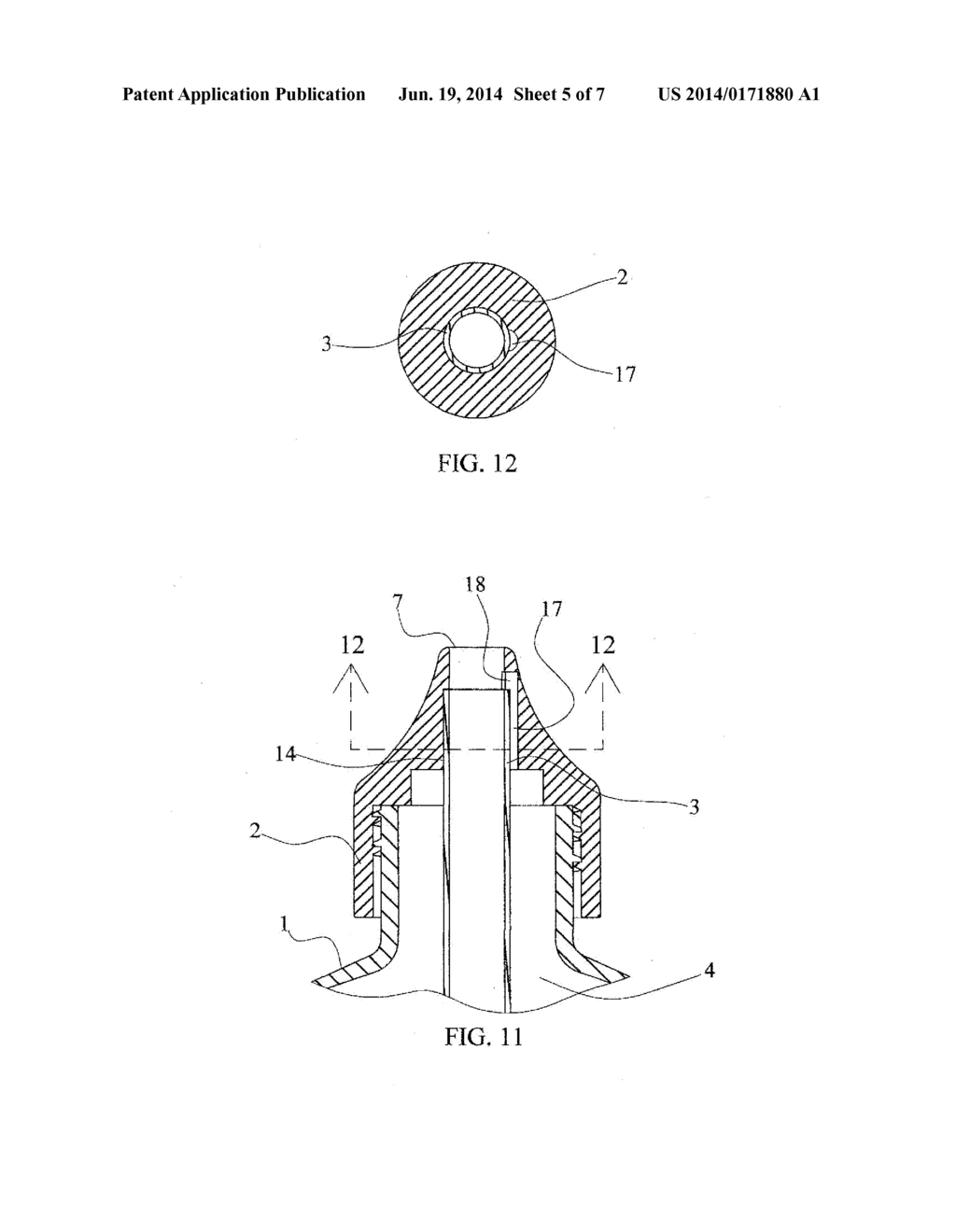 High Flow Volume Nasal Irrigation Device and Method for Alternating     Pulsatile and Continuous Fluid Flow - diagram, schematic, and image 06