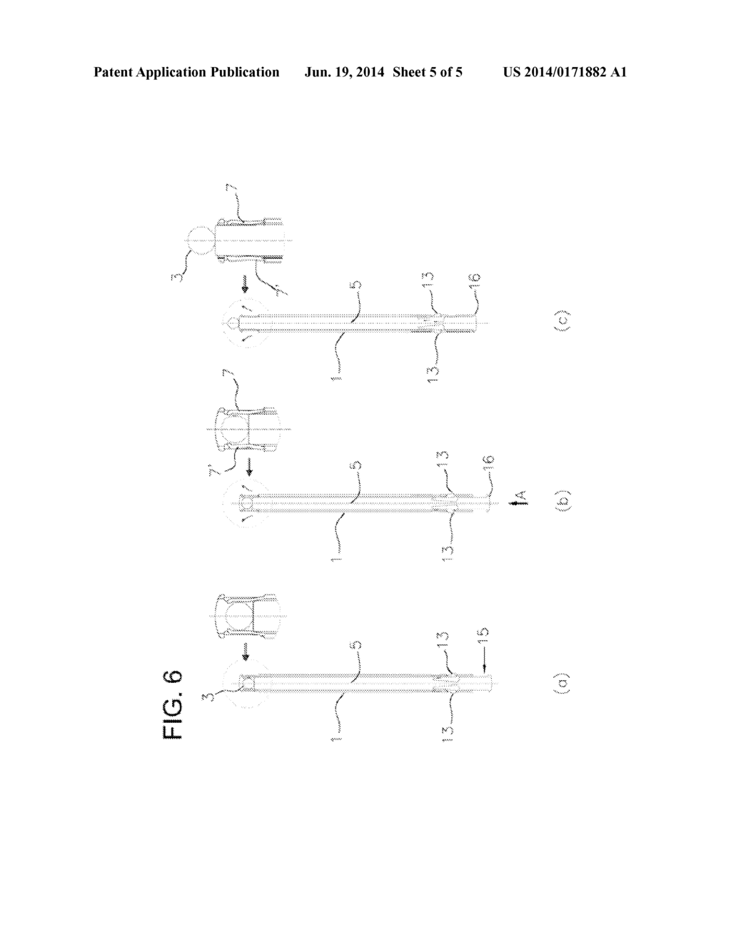 INSTRUMENT FOR INSERTING A SUPPOSITORY - diagram, schematic, and image 06