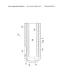 Vitrectomy Probe with Integral Valve diagram and image