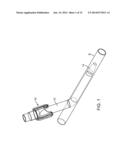 Vascular Closure Devices diagram and image