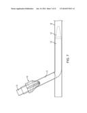 Vascular Closure Devices diagram and image