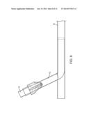 Vascular Closure Devices diagram and image