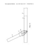 Vascular Closure Devices diagram and image