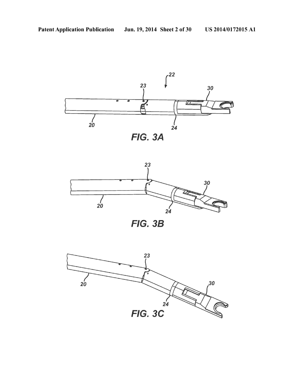 Surgical Needle with Formed Steps - diagram, schematic, and image 03