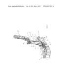 APPARATUS AND DEVICES FOR PERCUTANEOUSLY EXTENDING AN EXISTING SPINAL     CONSTRUCT diagram and image