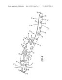 BONE PLATE FOR PLATE OSTEOSYNTHESIS AND METHOD FOR USE THEREOF diagram and image