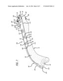 BONE PLATE FOR PLATE OSTEOSYNTHESIS AND METHOD FOR USE THEREOF diagram and image