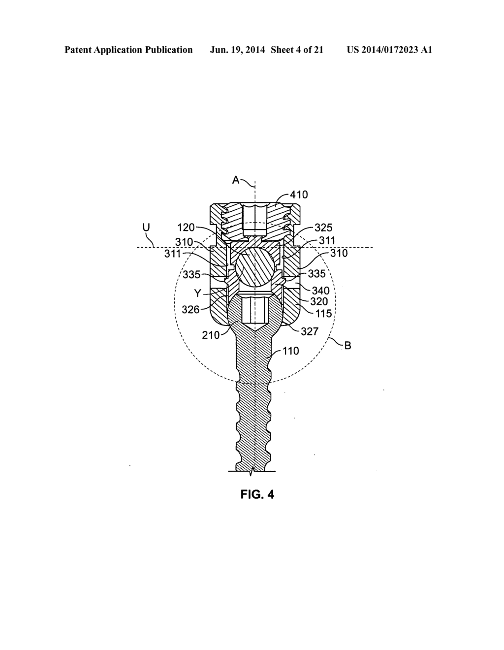 PEDICLE SCREW ASSEMBLY - diagram, schematic, and image 05