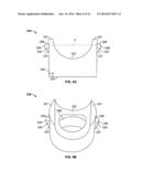 PEDICLE SCREW ASSEMBLY diagram and image