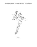 PEDICLE SCREW ASSEMBLY diagram and image