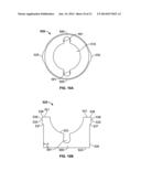 PEDICLE SCREW ASSEMBLY diagram and image