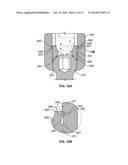 PEDICLE SCREW ASSEMBLY diagram and image