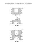 PEDICLE SCREW ASSEMBLY diagram and image