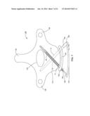 VERTEBRAL SCREW ARRANGEMENT WITH LOCKING PIN diagram and image