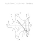 VERTEBRAL SCREW ARRANGEMENT WITH LOCKING PIN diagram and image