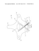 VERTEBRAL SCREW ARRANGEMENT WITH LOCKING PIN diagram and image