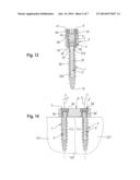 DYNAMIC BONE ANCHOR AND METHOD OF MANUFACTURING THE SAME diagram and image