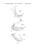 Methods and Devices for Portal Fixation to the Spine diagram and image