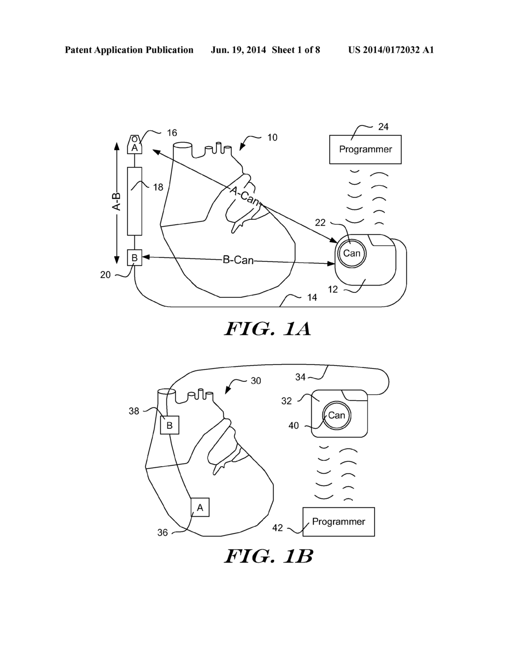 DATA MANIPULATION FOLLOWING DELIVERY OF A CARDIAC STIMULUS IN AN     IMPLANTABLE CARDIAC STIMULUS DEVICE - diagram, schematic, and image 02