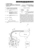 METHOD AND APPARATUS FOR RIGHT VENTRICULAR RESYNCHRONIZATION diagram and image