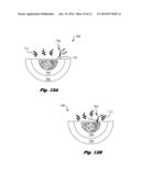 Nanoparticle-sized Magnetic Absorption Enhancers having Three-Dimensional     Geometries Adapted for Improved Diagnostics and Hyperthermic Treatment diagram and image