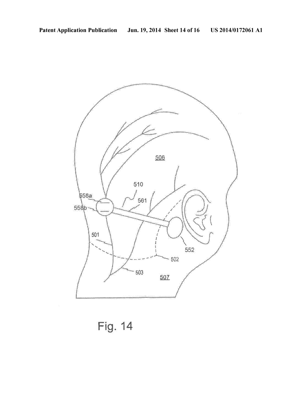 Devices and Methods for Low Current Neural Modulation - diagram, schematic, and image 15