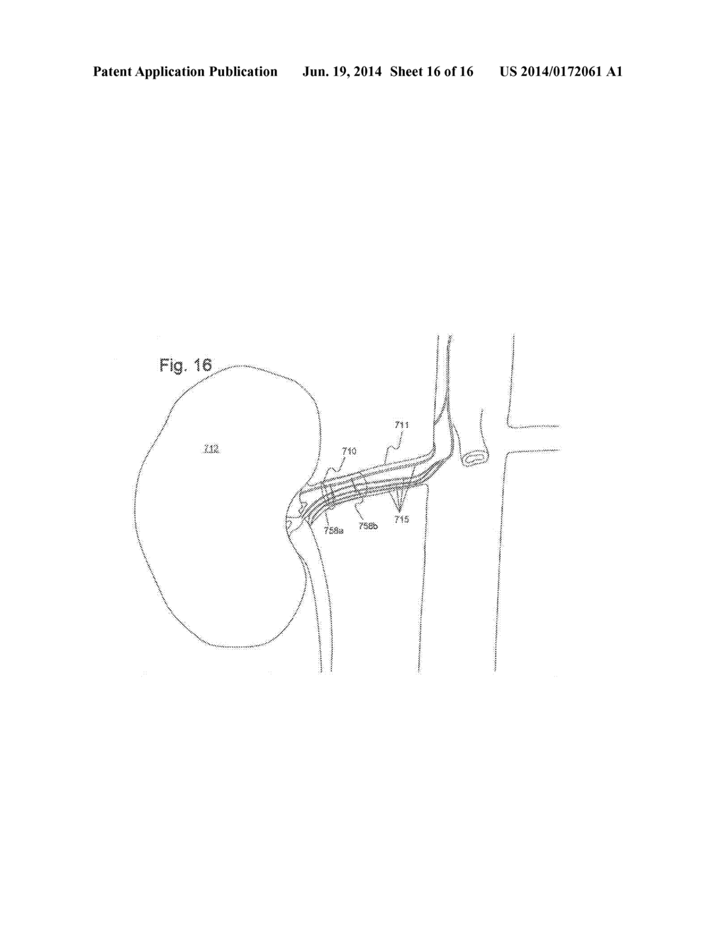 Devices and Methods for Low Current Neural Modulation - diagram, schematic, and image 17