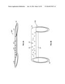 VASCULAR STENTING FOR ANEURYSMS diagram and image